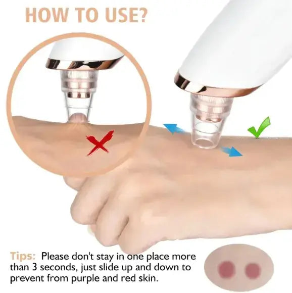 How to use the Pore Purifier Pro for effective blackhead removal on skin with tips for better results.
